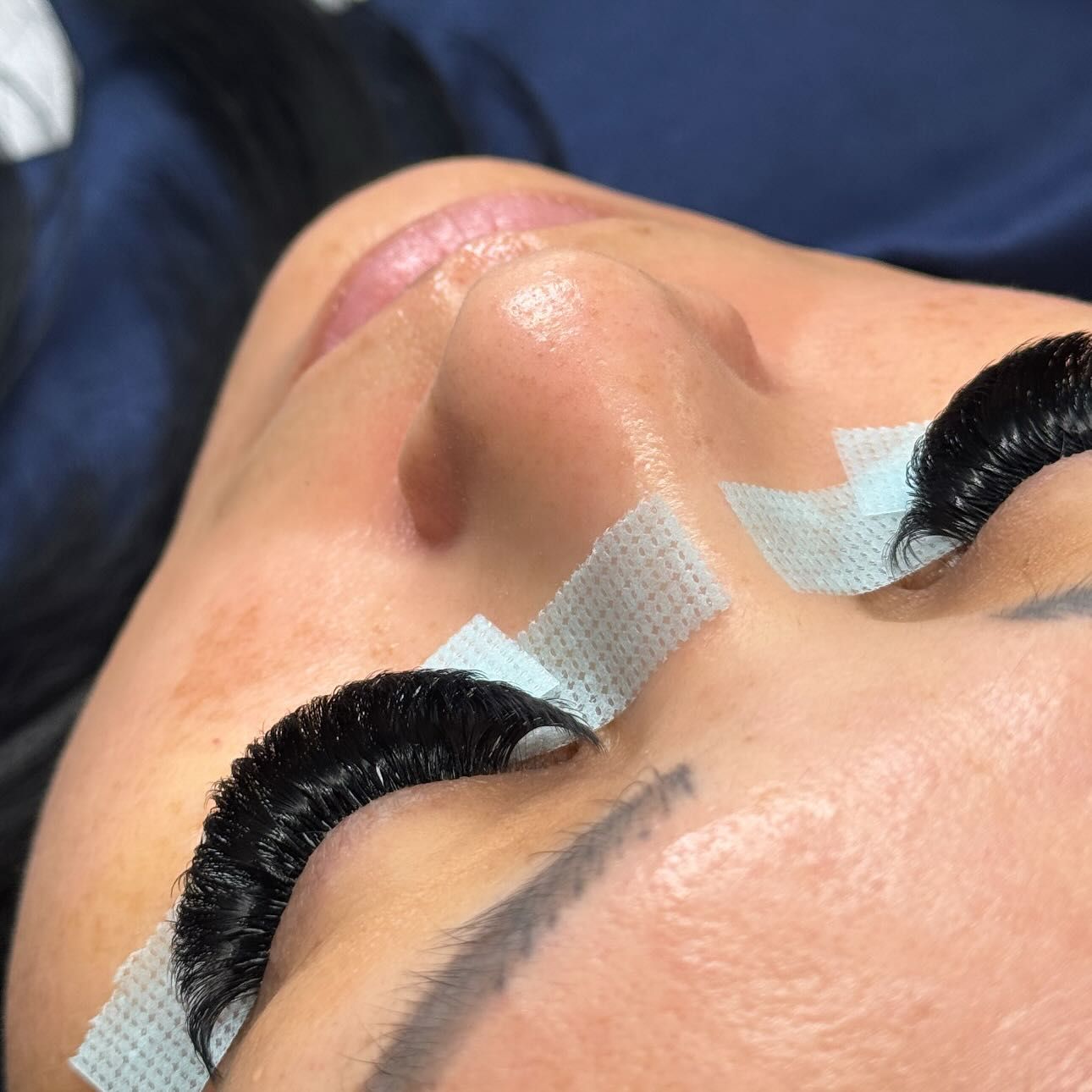 Volume set, both eyes, from above